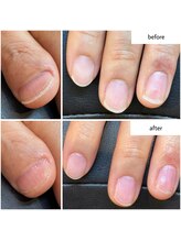 ケアプラス(care plus)/ハンドネイルケア