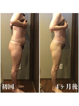 ムーン(MOON)/痩身エステ上半身コース