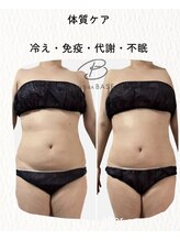 インディバ ベース(INDIBA BASE)/インディバボディ