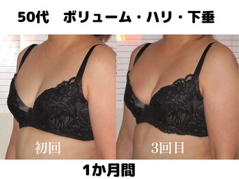 バストサロン メルベイユ(Merveile)/バスト位置、デコルテから丸みUP