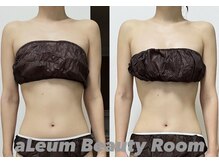 インディバ60分１ヶ月の変化/肩首コリケア◇お腹までスッキリ♪