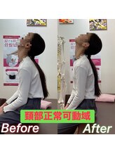 ヒデ整体院(Hide整体院)/猫背矯正骨盤矯正B/A肩こり腰痛
