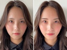 メイロ 名駅店(meiro)/before after