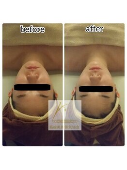 筋線美術コルギ 目黒店/新規予約特典実施中