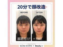 ブリングホワイト プラス ビューティーイズ(BLING WHITE + Beauty iS)の雰囲気（【初回体験がお得！】プロ用高級マシンを全てご体験）