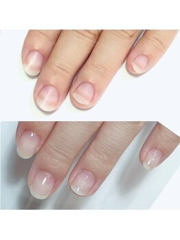 イマイロ(Imairo)/自爪育成/ハンドケア/美フォルム