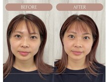 【美顔シンメ技法】瞼の弛み/小顔/疲れ目/頭重/エラ張りetc．