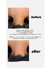 ウネ 吉祥寺(une)/ブライダルや女性に大人気！