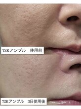 ボヌールエターナル(Bonheur eternel)/