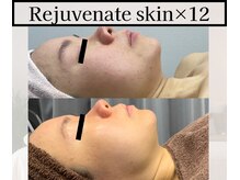 ミックスアップ 池袋店(Mix up!!)/フェイシャル技術の効果