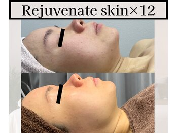 ミックスアップ 池袋店(Mix up!!)/フェイシャル技術の効果