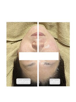 トランク(Trunk)/エアバリ♪before→after