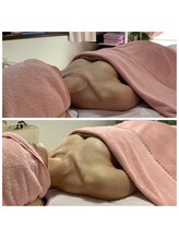 エジュール(EJURE)/ミラクルバストビフォーアフター