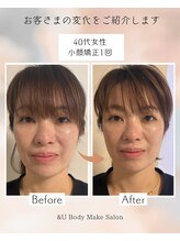 アンドユー(&U)/