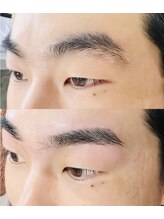 ケープラス(K Plus+)/before→after