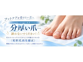 巻き爪補正店　南流山店【11月5日OPEN（予定）】の写真/分厚い爪・深爪・変色爪でお悩みの方へ◎なかなか改善しなかったお悩みは豊富な経験と技術で改善！