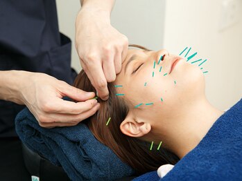 ハリハリ(HALIHALI)/お顔の鍼施術☆