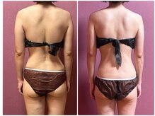 ビマリア(美-MARIA)