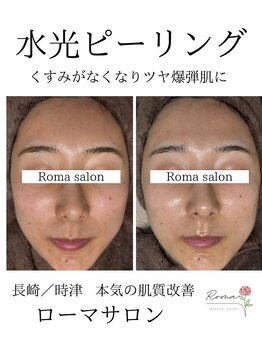 ローマサロン/つるんとむきたまごの水光肌♪