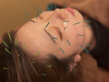 エイチスリー 外苑前院の雰囲気（外苑前駅近！体のメンテナンスだけでなく美容鍼もおすすめ☆）