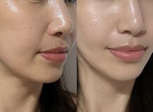 ツヤハダコガオ 千葉店