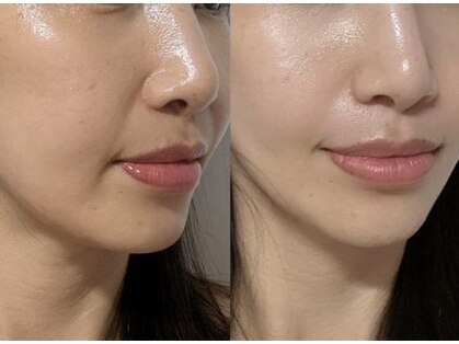 ツヤハダコガオ 千葉店の写真