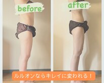 ヨサパーク ハロ(YOSA PARK Haro)