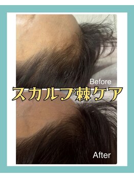 リリベル(LilyBell)/Before After