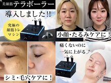 赤筋を鍛えて叶えるダウンタイムなし小顔ケア【テラボーラー】¥12,000