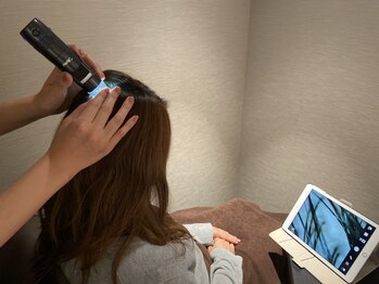 リコンテ(Reconte)/マイクロスコープによる頭皮診断
