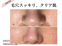 アイリスビューティーサロン(iRiS Beauty salon)の雰囲気（黒ずみ、産毛を根本除去！毛穴ケア&EMS&幹細胞の極上ケア！）