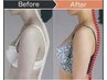 ≪バスト≫【美胸メソッド】美骨筋矯正リンパ×エナジー美電流3ヶ月12回集中