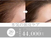 サロンリシェ(salon riche)の雰囲気（プロセルセラピーズ/育毛促進ケア）