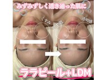 サロン(SALON)/ララピール+LDM