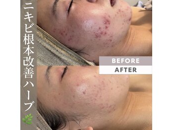 アトリエリン 小牧本店(Atelier Rin)/プライベートサロン