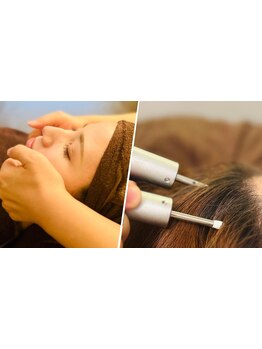 小顔になりたい