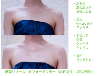 ビューティサロン オハナ(ohana)/左右の肩の高さが揃い美鎖骨♪
