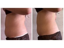 サロンドリマ(Salon de Lima)の雰囲気（レモンボトル4回目で－4.5センチ！！）