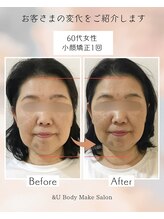 アンドユー(&U)/