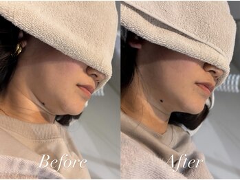 ハクト(Hakuto)/Before/After