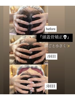エスドット ビューティーサロン(S.beauty salon)の写真/モデルも通う♪【頭蓋骨矯正＋小顔矯正90分¥8800】解剖学×ヘッドマスターで頭ごと小さく!