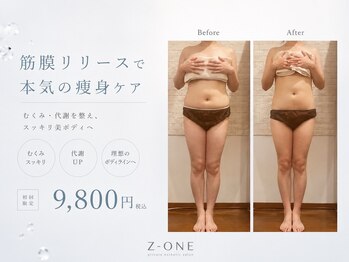 うつくし痩身 美サロン ゼットワン(Z-ONE)の写真/【お得な全身初回90分￥9800♪】基礎代謝向上の健康的な筋膜リリースメディセルで老廃物の排出を促進◎