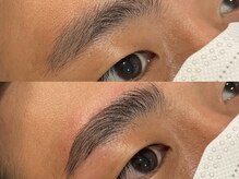 ビクシー(vixxcy)/メンズビフォーアフター