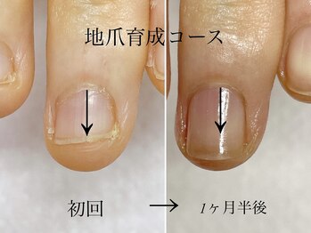 トゥインクリーネイルサロン(Twinkly Nail Salon)/【最強のネイルケア】1回お試し