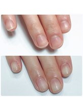 イマイロ(Imairo)/自爪育成/ハンドケア/美フォルム