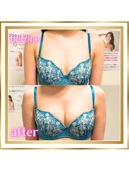 ジュエルリング(Jewel Ring)/バストアップ・育乳・恵比寿