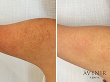 アベニール 芦屋/体のお悩みもなくなる