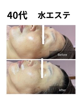 ヒール(heal)/小顔、むくみスッキリ