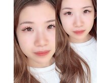 アンドユー(&you)/ダブルフラット100束