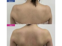 慢性疲労の方は【最新マシン高周波ラジオ派＋全身オイル】